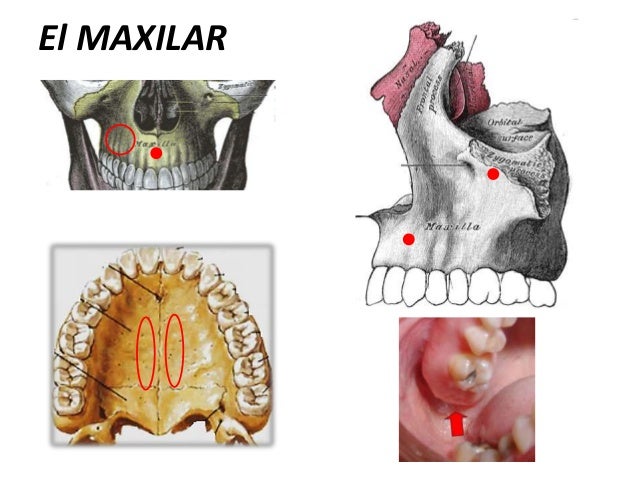 Microimplantes En Ortodoncia Pdf